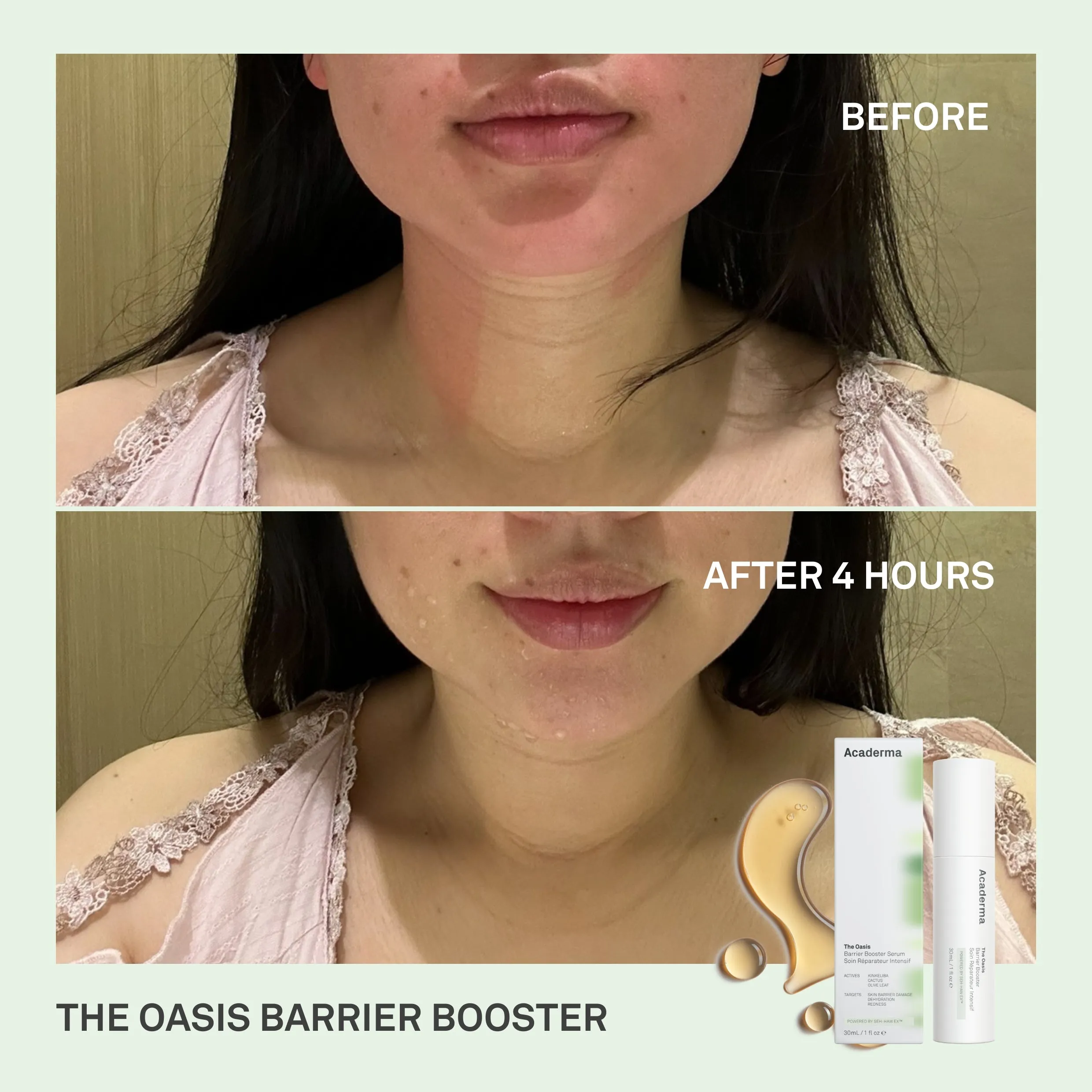 Acaderma The Oasis Barrier Booster Serum