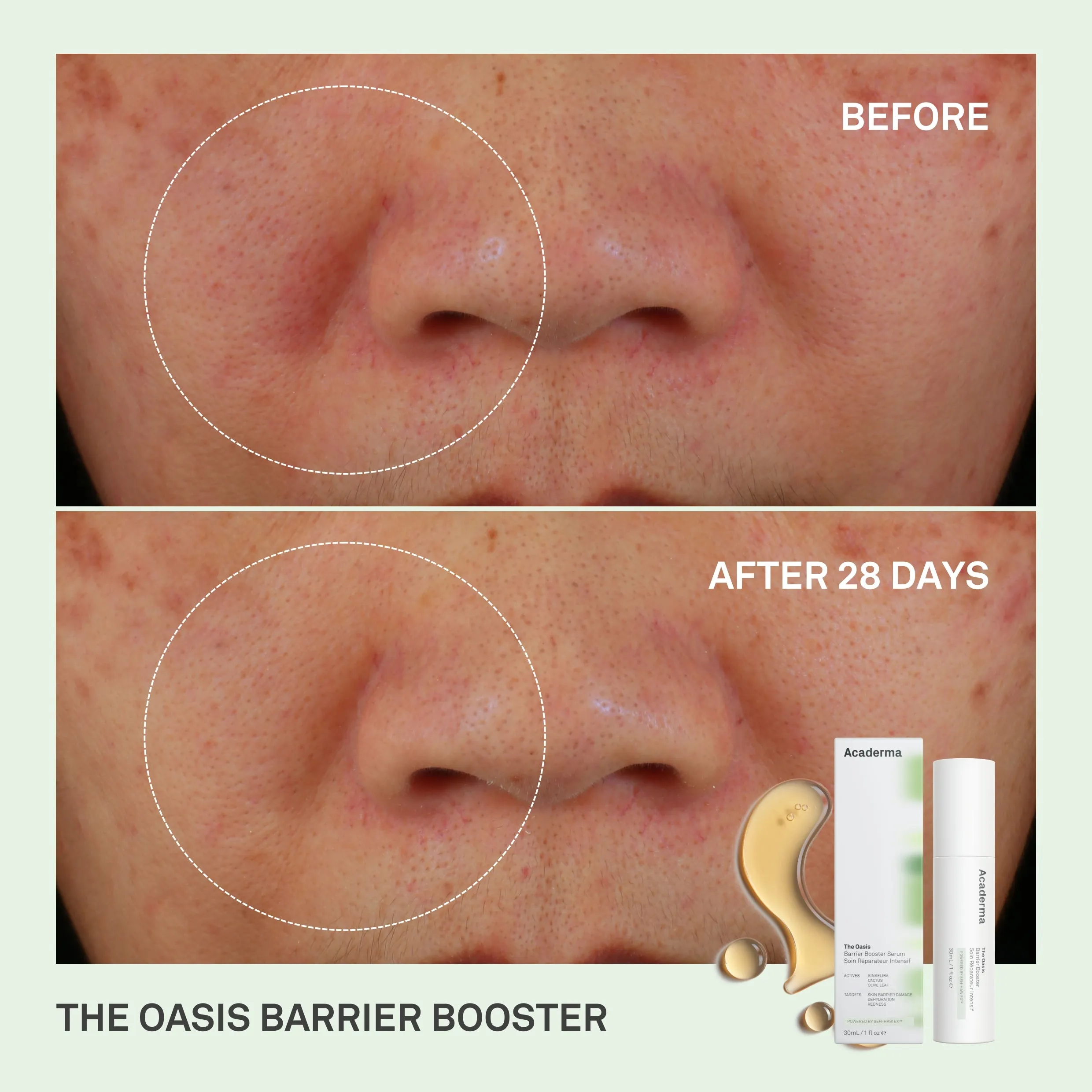 Acaderma The Oasis Barrier Booster Serum