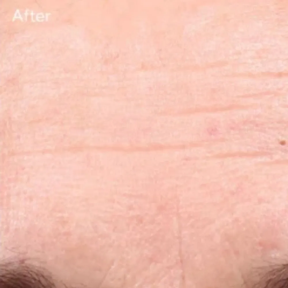 Murad Retinol Youth Renewal Serum Advanced