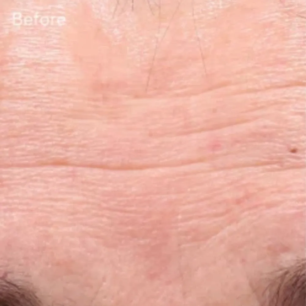 Murad Retinol Youth Renewal Serum Advanced