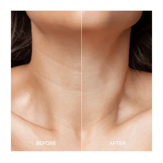 NOT4U Firming Up Neck Serum 30g